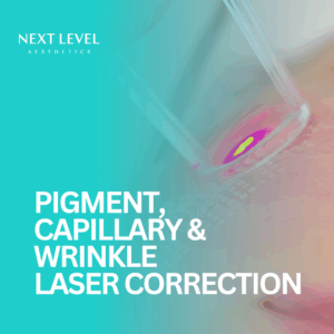 Pigment, Capillary & Wrinkle LASER Correction