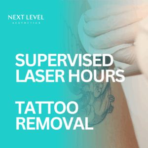 Supervised LASER Hours (Tattoo Removal)